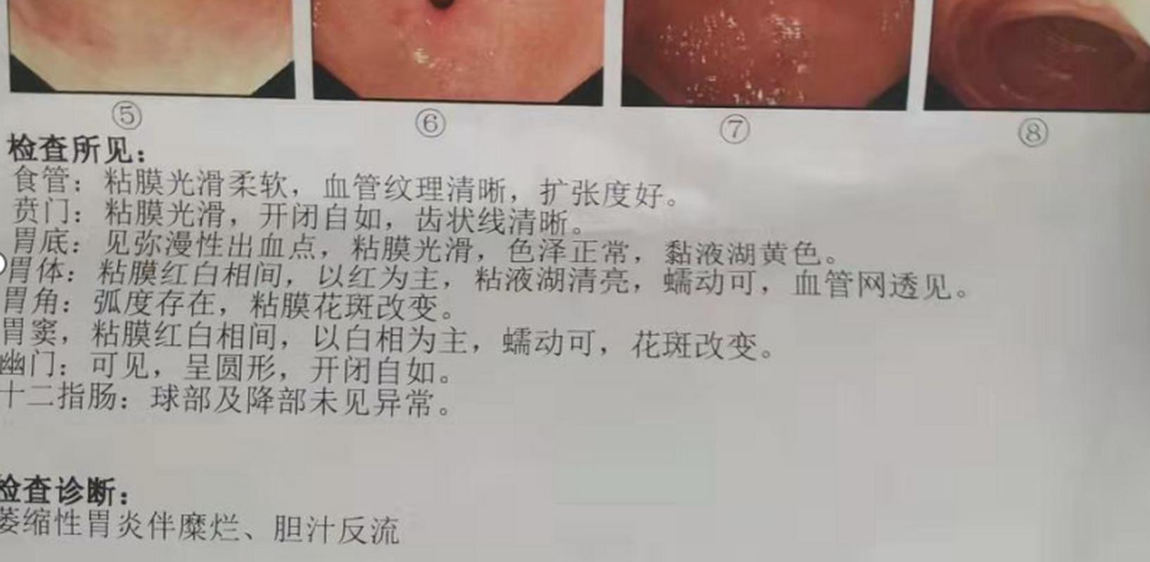 澳門6合開獎(jiǎng)結(jié)果和戀愛后莫名口臭胃痛與談戀愛口臭