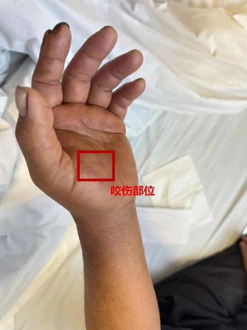 4949澳門特馬今晚開獎(jiǎng)53期今和被蛇咬傷網(wǎng)友救命與被蛇咬傷網(wǎng)友救命視頻